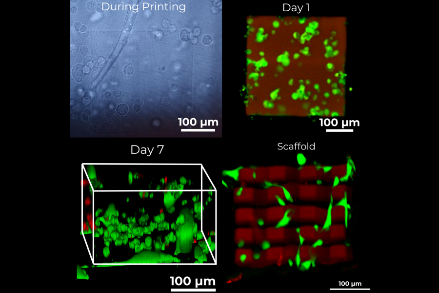 Live cell printing at the microscale: Printing of a microstructure in the presence of fibroblast cells on a Nanoscribe Photonic Professional GT2 system: during printing, after 1 day of cell culture and after 7 days of culture and a printed scaffold in the presence of fibrosarcoma cells (green cells are alive, red cells are dead).