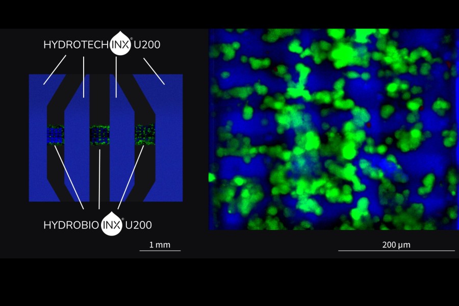Multimaterial microfluidic cancer-on-chip printed under sterile conditions using HYDROTECH INX U200 for the outer geometry inner scaffold structures printed from cell compatible HYDROBIO INX© U200 with encapsulated Breast cancer cells.