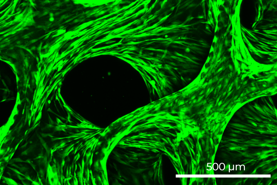 seeded cells on DEGRES INX scaffold