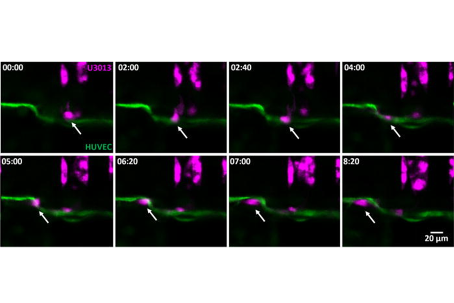 Time-lapse of a U3013 (magenta) reaching and migrating along the endothelial monolayer with penetration in the HUVEC barrier (green) between time point 05:00 and 06:20. Top view, time format (hh:mm).