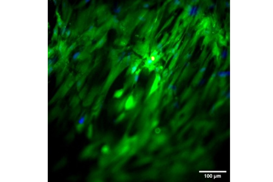 Dental pulp stem cells seeded on a volumetrically printed READYPCL INX construct, printed with Readily3D’s Tomolite v2.0