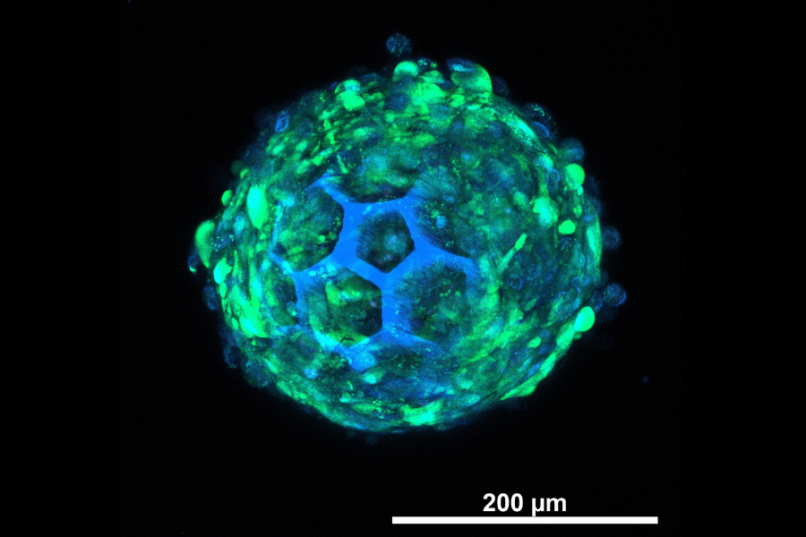 The cells are green in colour with blue nuclei, along with the blue colour struts of BB (because of autofluorescence). (Image credit to Rathina Vel Balasubramanian from TU Wien)