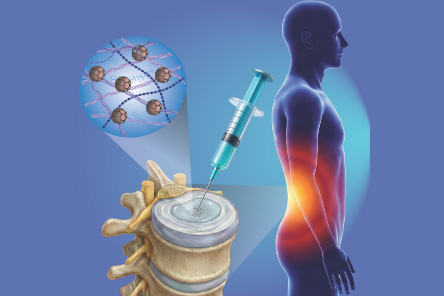 Bioprinting Breakthrough Offers New Hope for Low Back Pain Relief (Image credit to Rathina Vel Balasubramanian from TU Wien)