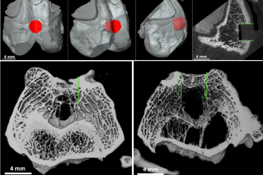 Top: 3D image of the introduced defect and µCT image of the defect before treatment.  Bottom Left: µCT image of a knee joint treated with the cell containing 3D printed microscaffolds. Bottom right: the control group (right), where the green lines indicate the diameter and depth of the created defect. A clear improvement is observed in the treated group. (Image Courtesy of TUWIEN)