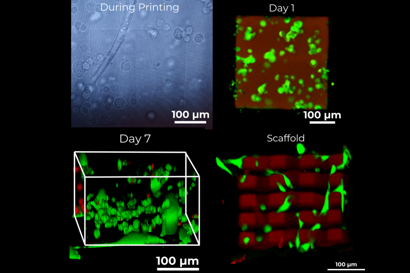 Live cell printing at the microscale: Printing of a microstructure in the presence of fibroblast cells on a Nanoscribe Photonic Professional GT2 system: during printing, after 1 day of cell culture and after 7 days of culture and a printed scaffold in the presence of fibrosarcoma cells (green cells are alive, red cells are dead).