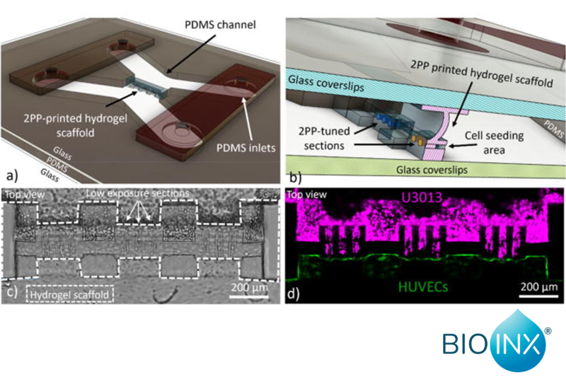 Advancing Cancer Research with 3D Bioprinting