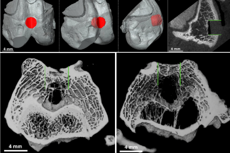 Top: 3D image of the introduced defect and µCT image of the defect before treatment.  Bottom Left: µCT image of a knee joint treated with the cell containing 3D printed microscaffolds. Bottom right: the control group (right), where the green lines indicate the diameter and depth of the created defect. A clear improvement is observed in the treated group. (Image Courtesy of TUWIEN)